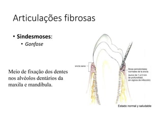 Articulações fibrosas
• Sindesmoses:
• Gonfose
Meio de fixação dos dentes
nos alvéolos dentários da
maxila e mandíbula.
 