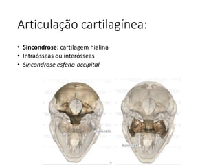 Articulação cartilagínea:
• Sincondrose: cartilagem hialina
• Intraósseas ou interósseas
• Sincondrose esfeno-occipital
 