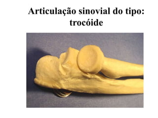 Articulação sinovial do tipo:
trocóide
 