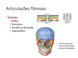 Articulações fibrosas:
• Suturas:
• Plana
• Escamosa
• Serrátil ou denteada
• Esquindilese
• Sutura internasal
• Sutura intermaxilar
• Sutura interpalatina
 