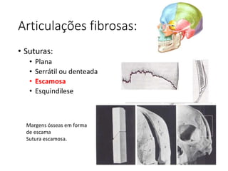 Articulações fibrosas:
• Suturas:
• Plana
• Serrátil ou denteada
• Escamosa
• Esquindilese
Margens ósseas em forma
de escama
Sutura escamosa.
 