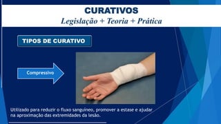 CURATIVOS
Legislação + Teoria + Prática
TIPOS DE CURATIVO
Compressivo
Utilizado para reduzir o fluxo sanguíneo, promover a estase e ajudar
na aproximação das extremidades da lesão.
 