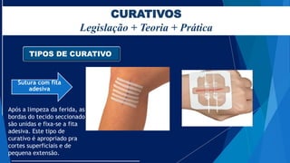 CURATIVOS
Legislação + Teoria + Prática
TIPOS DE CURATIVO
Sutura com fita
adesiva
Após a limpeza da ferida, as
bordas do tecido seccionado
são unidas e fixa-se a fita
adesiva. Este tipo de
curativo é apropriado pra
cortes superficiais e de
pequena extensão.
 