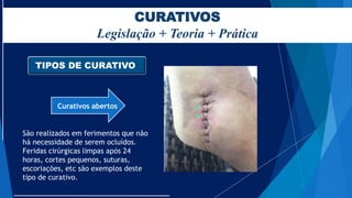 CURATIVOS
Legislação + Teoria + Prática
TIPOS DE CURATIVO
Curativos abertos
São realizados em ferimentos que não
há necessidade de serem ocluídos.
Feridas cirúrgicas limpas após 24
horas, cortes pequenos, suturas,
escoriações, etc são exemplos deste
tipo de curativo.
 