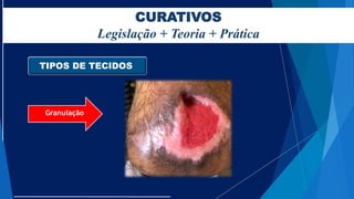 CURATIVOS
Legislação + Teoria + Prática
TIPOS DE TECIDOS
Granulação
FOTO
 