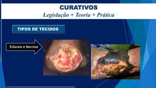 CURATIVOS
Legislação + Teoria + Prática
TIPOS DE TECIDOS
Esfacelo e Necrose
 
