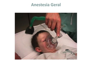 Anestesia Geral
 