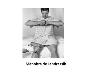 Manobra de Jendrassik
 