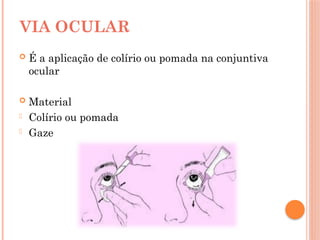  É a aplicação de colírio ou pomada na conjuntiva
ocular
 Material
- Colírio ou pomada
- Gaze
VIA OCULAR
 