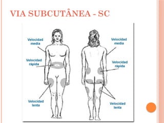 VIA SUBCUTÂNEA - SC
 