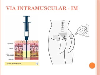 VIA INTRAMUSCULAR - IM
 