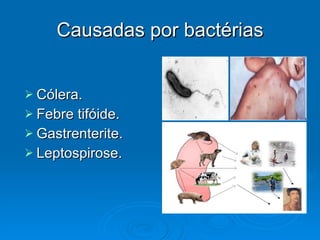 Causadas por bactérias Cólera. Febre tifóide. Gastrenterite. Leptospirose. 