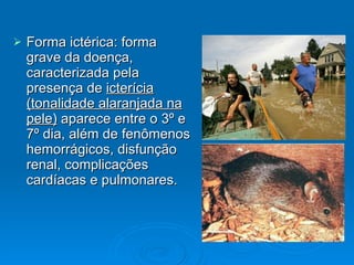 Forma ictérica: forma grave da doença, caracterizada pela presença de  icterícia (tonalidade alaranjada na pele)  aparece entre o 3º e 7º dia, além de fenômenos hemorrágicos, disfunção renal, complicações cardíacas e pulmonares. 