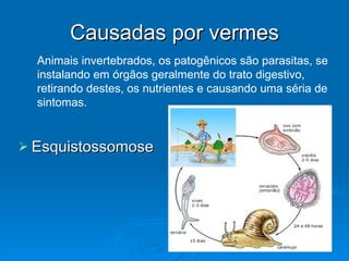 Causadas por vermes Esquistossomose  Animais invertebrados, os patogênicos são parasitas, se instalando em órgãos geralmente do trato digestivo, retirando destes, os nutrientes e causando uma séria de sintomas. 