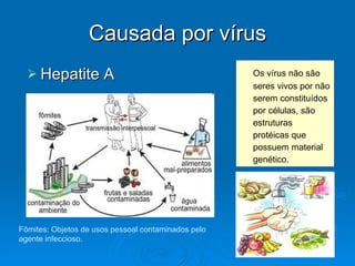 Causada por vírus Hepatite A  Fômites: Objetos de usos pessoal contaminados pelo agente infeccioso. Os vírus não são seres vivos por não serem constituídos por células, são estruturas protéicas que possuem material genético. 