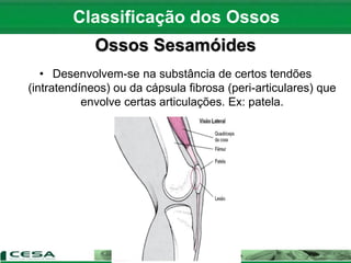 Ossos Sesamóides
• Desenvolvem-se na substância de certos tendões
(intratendíneos) ou da cápsula fibrosa (peri-articulares) que
envolve certas articulações. Ex: patela.
Classificação dos Ossos
 
