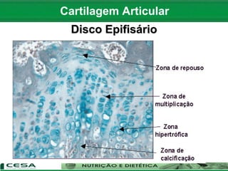 Cartilagem Articular
Disco Epifisário
 