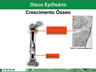 Disco Epifisário
Crescimento Ósseo
 