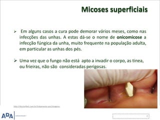 Micoses superficiais
 Em alguns casos a cura pode demorar vários meses, como nas
infecções das unhas. A estas dá-se o nome de onicomicose a
infecção fúngica da unha, muito frequente na população adulta,
em particular as unhas dos pés.
 Uma vez que o fungo não está apto a invadir o corpo, as tinea,
ou frieiras, não são consideradas perigosas.
http://doctorfeet.com.br/tratamento-pes/imagens-
yaslip/informacoes/tratamento-frieiras-01.jpg
 