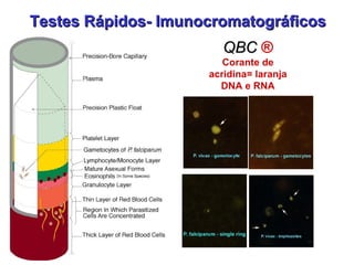 QBCQBC ®
Corante de
acridina= laranja
DNA e RNA
Testes Rápidos- ImunocromatográficosTestes Rápidos- Imunocromatográficos
 