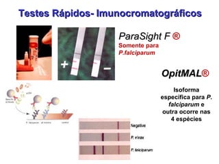 ParaSight FParaSight F ®
Somente para
P.falciparum
Testes Rápidos- ImunocromatográficosTestes Rápidos- Imunocromatográficos
OpitMALOpitMAL®
Isoforma
específica para P.
falciparum e
outra ocorre nas
4 espécies
 