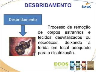 DESBRIDAMENTO
Processo de remoção
de corpos estranhos e
tecidos desvitalizados ou
necróticos, deixando a
ferida em local adequado
para a cicatrização.
 