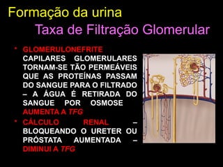 Formação da urina
• GLOMERULONEFRITE –
CAPILARES GLOMERULARES
TORNAM-SE TÃO PERMEÁVEIS
QUE AS PROTEÍNAS PASSAM
DO SANGUE PARA O FILTRADO
– A ÁGUA É RETIRADA DO
SANGUE POR OSMOSE –
AUMENTA A TFG.
• CÁLCULO RENAL –
BLOQUEANDO O URETER OU
PRÓSTATA AUMENTADA –
DIMINUI A TFG.
Taxa de Filtração Glomerular
 