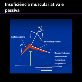 Insuficiência muscular ativa e
passiva
 