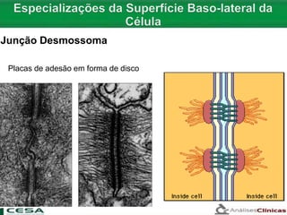 Placas de adesão em forma de disco
Junção Desmossoma
 
