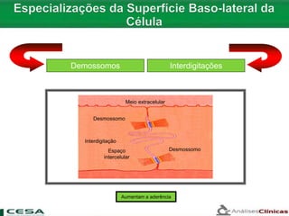 Meio extracelular
Desmossomo
Interdigitação
Espaço
intercelular
Desmossomo
Demossomos Interdigitações
Aumentam a aderência
 