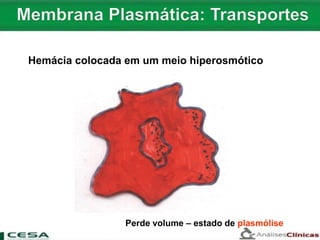 Hemácia colocada em um meio hiperosmótico
Perde volume – estado de plasmólise
 