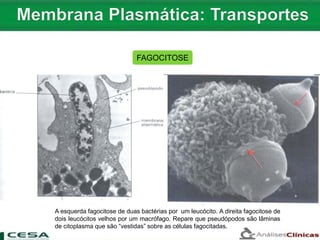 FAGOCITOSE
A esquerda fagocitose de duas bactérias por um leucócito. A direita fagocitose de
dois leucócitos velhos por um macrófago. Repare que pseudópodos são lâminas
de citoplasma que são “vestidas” sobre as células fagocitadas.
 
