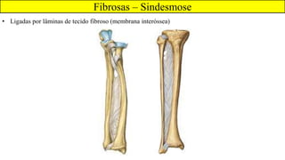 Fibrosas – Sindesmose
• Ligadas por lâminas de tecido fibroso (membrana interóssea)
 