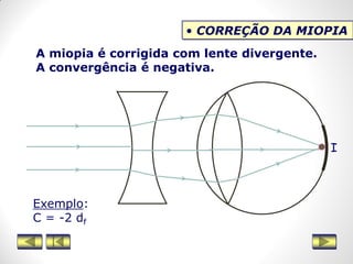 • CORREÇÃO DA MIOPIA
A miopia é corrigida com lente divergente.
A convergência é negativa.
Exemplo:
C = -2 df
I
 