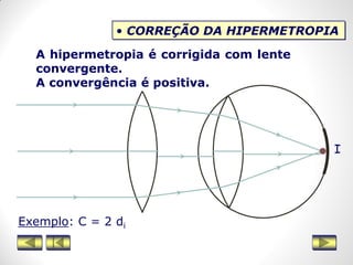 • CORREÇÃO DA HIPERMETROPIA
A hipermetropia é corrigida com lente
convergente.
A convergência é positiva.
Exemplo: C = 2 di
I
 