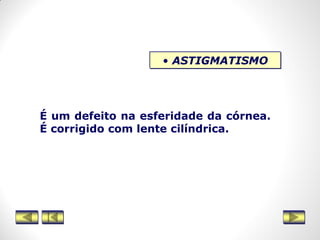 • ASTIGMATISMO
É um defeito na esferidade da córnea.
É corrigido com lente cilíndrica.
 