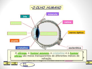 •O OLHO HUMANO
1o)
Caso
Humor vítreo
nervo óptico
esclerótica
retina
córnea
íris
humor aquoso
músculo
pupila
cristalino
A luz penetra no olho através de um diafragma (a íris);
íris
No centro da íris há uma abertura (a Pupila) que aumenta
ou diminui de diâmetro conforme a intensidade luminosa.
pupila
cristalino
O cristalino é uma lente cuja distância focal pode ser alterada
pela ação do músculo ciliar. Ao se contrair o músculo altera a
curvatura da superfície do cristalino. Esse mecanismo permite a
formação de imagens nítidas sobre a retina.
retina
A luz passa em seguida por uma lente convergente (o
cristalino) e atinge uma membrana sensível (a retina).
nervo óptico
O nervo óptico ,mediante um código de sinais nervosos,
transmite ao cérebro a imagem formada sobre a retina.
A Pupila é comandada por um músculo que regula seu
diâmetro, permitindo-o variar de cerca de 2 a 9 mm,
conforme a intensidade de luz incidente.
músculo
córnea
humor aquoso humor vítreo
A córnea, o humor aquoso, o cristalino e o humor
vítreo são meios transparentes de diferentes índices de
refração.
 