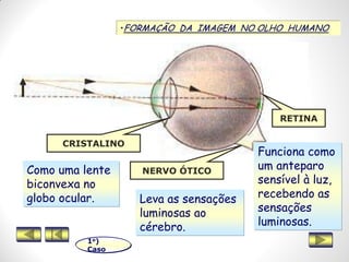 •FORMAÇÃO DA IMAGEM NO OLHO HUMANO
CRISTALINO
NERVO ÓTICO
RETINA
Como uma lente
biconvexa no
globo ocular. Leva as sensações
luminosas ao
cérebro.
Funciona como
um anteparo
sensível à luz,
recebendo as
sensações
luminosas.
1o)
Caso
 