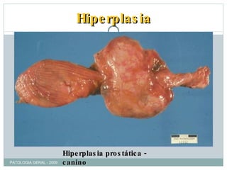 Hiperplasia Hiperplasia prostática - canino PATOLOGIA GERAL - 2009 