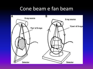 Cone beam e fan beam

 