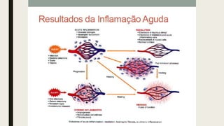 AULA 06_INFLAMAÇÃO.pdf