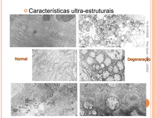 Características ultra-estruturais Pato Geral - CGF - 2009/2 Normal Degeneração 13-15/10/2009 