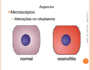 Microscópico Alterações no citoplasma 13-15/10/2009 Pato Geral - CGF - 2009/2 normal eosinofilia 