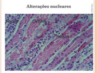 Pato Geral - CGF - 2009/2 13-15/10/2009 Picnose Cariólise Normal 