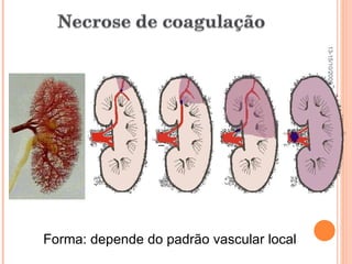 Pato Geral - CGF - 2009/2 Forma: depende do padrão vascular local 13-15/10/2009 
