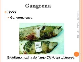 Tipos Gangrena seca 13-15/10/2009 Pato Geral - CGF - 2009/2 Ergotismo: toxina do fungo  Claviceps purpurea 