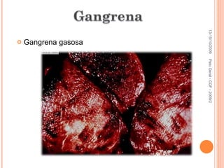 Gangrena gasosa 13-15/10/2009 Pato Geral - CGF - 2009/2 