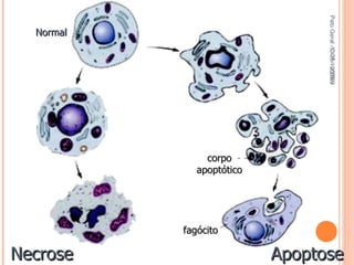 Pato Geral - CGF - 2009/2 13-15/10/2009 Normal Necrose fagócito corpo apoptótico Apoptose 