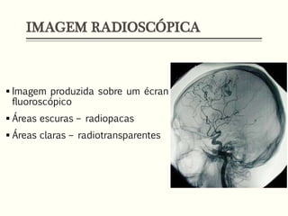 IMAGEM RADIOSCÓPICA
 Imagem produzida sobre um écran
fluoroscópico
 Áreas escuras – radiopacas
 Áreas claras – radiotransparentes
 