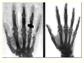 TOMOGRAFIA COMPUTADORIZADA
 